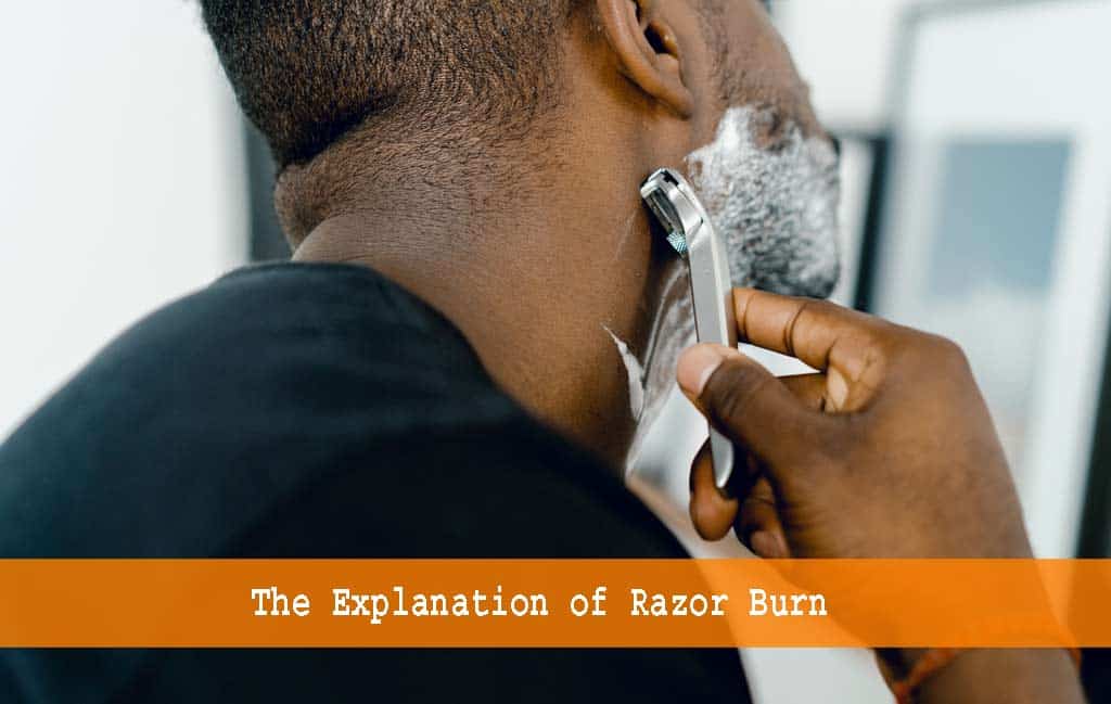 Explanation of razor burn