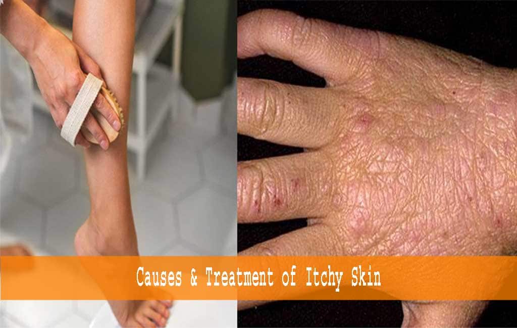 Itchy skin problem & solution for old people